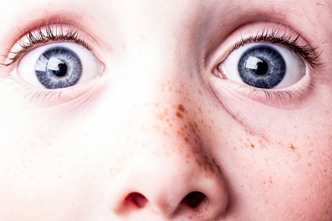 Image - surprised blue eyes freckles see