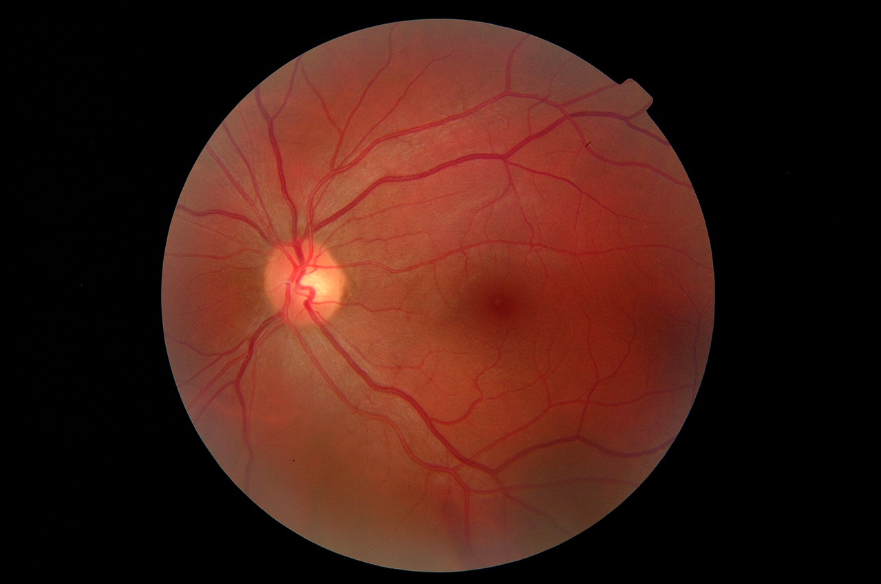 Image - eye fundus close