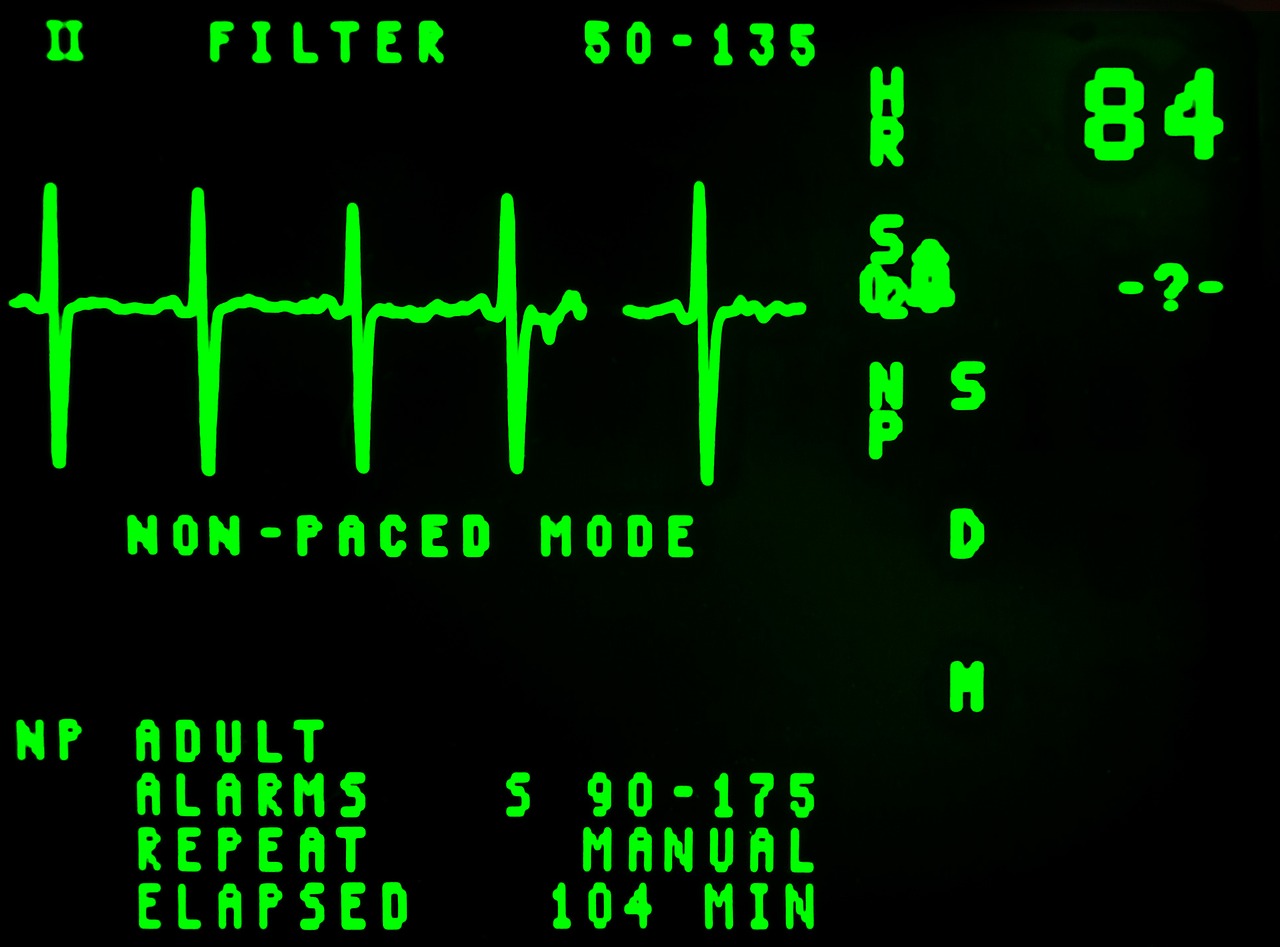 Image - electrocardiogram beat cardiology