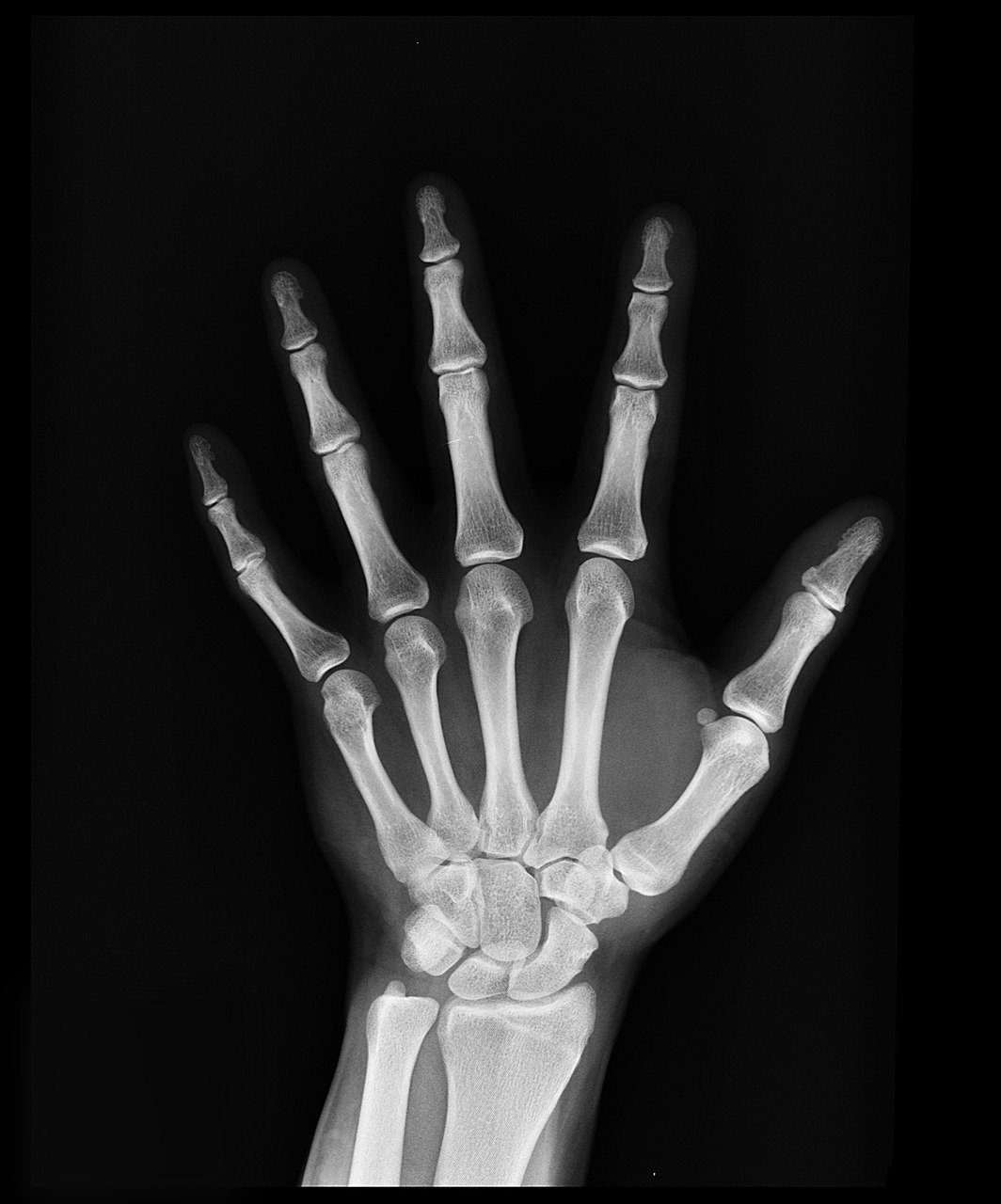 Image - x ray health arm doctors medicine