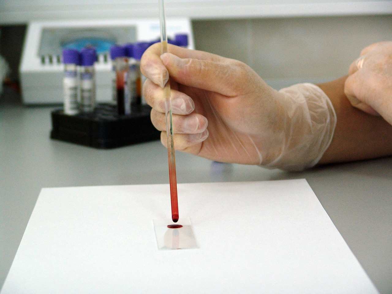 Image - blood sample lab laboratory