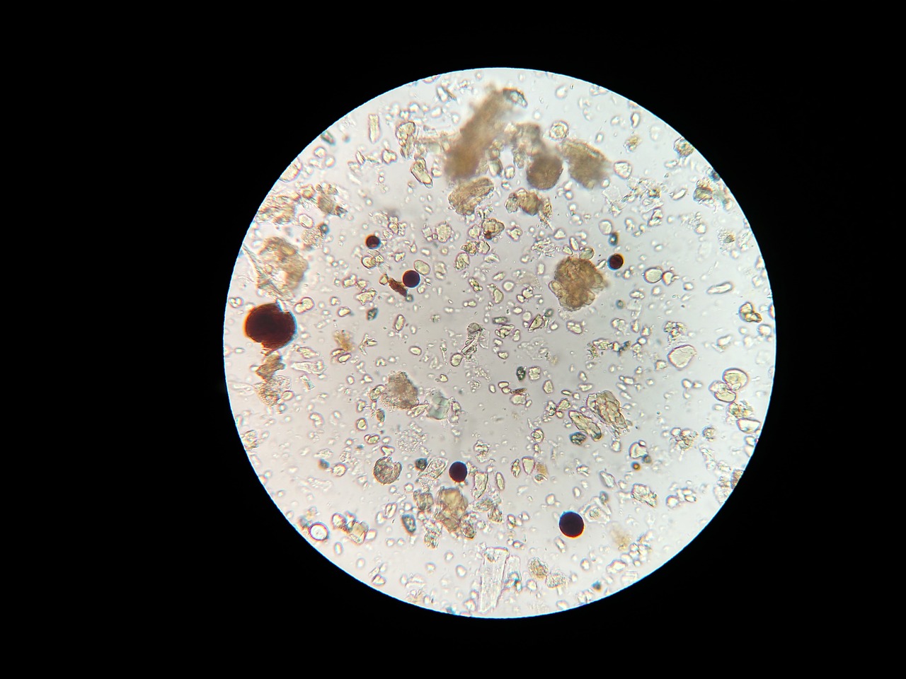 Image - soil microbes microscope soil sample