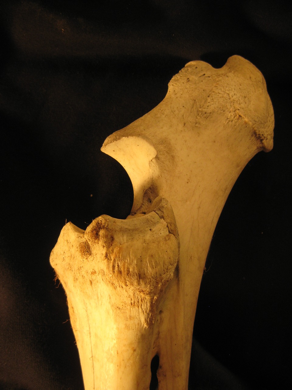 Image - bone radius ulna skeleton anatomy