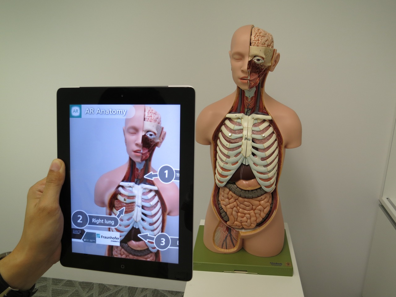 Image - augmented reality medical 3d