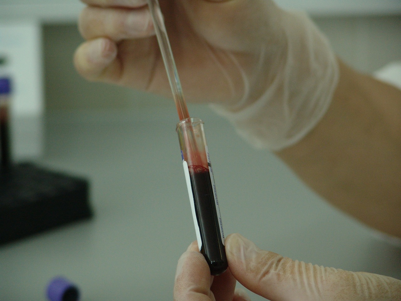 Image - blood vial analysis laboratory