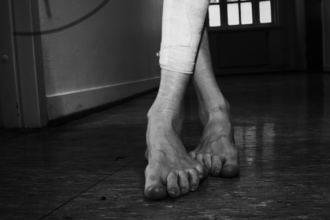 Image - feet legs woman human scars