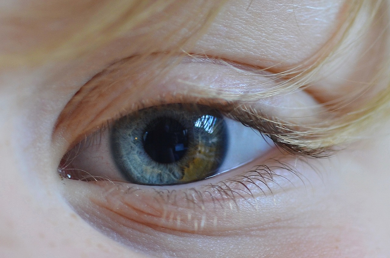 Image - eye color yellow view blue iris