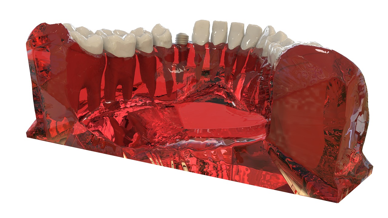 Image - teeth jaw 3d model orthodontics