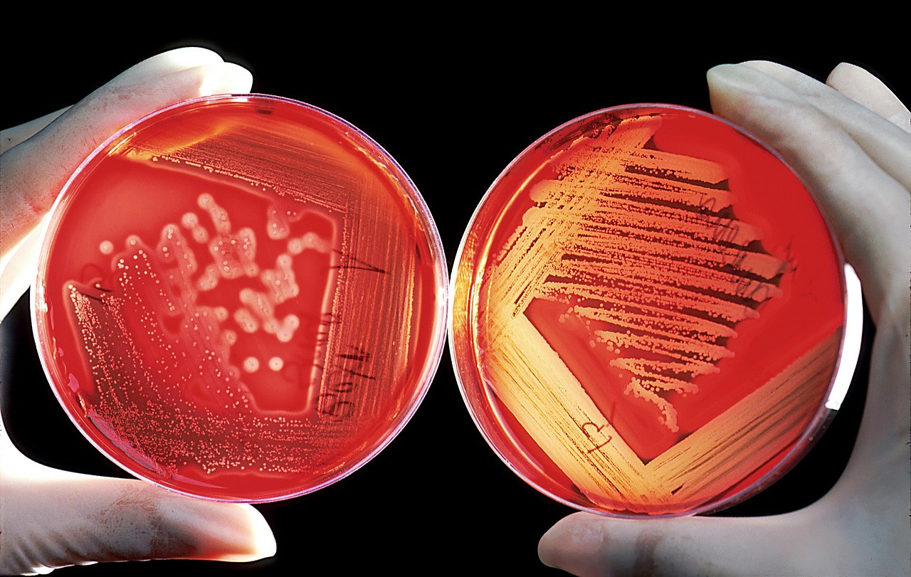 Image - agar breeding ground red